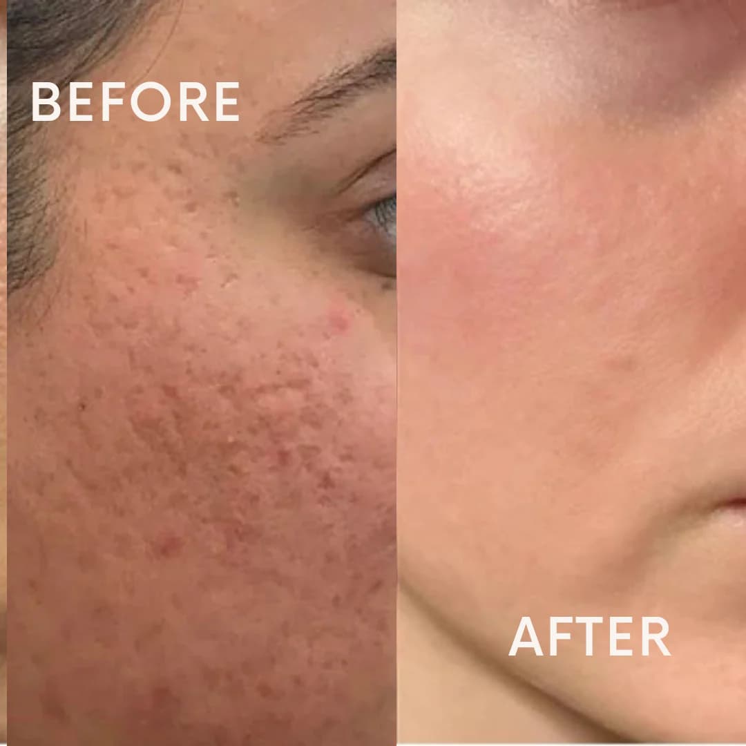 Skin & Beauty Care (त्वचारोग)